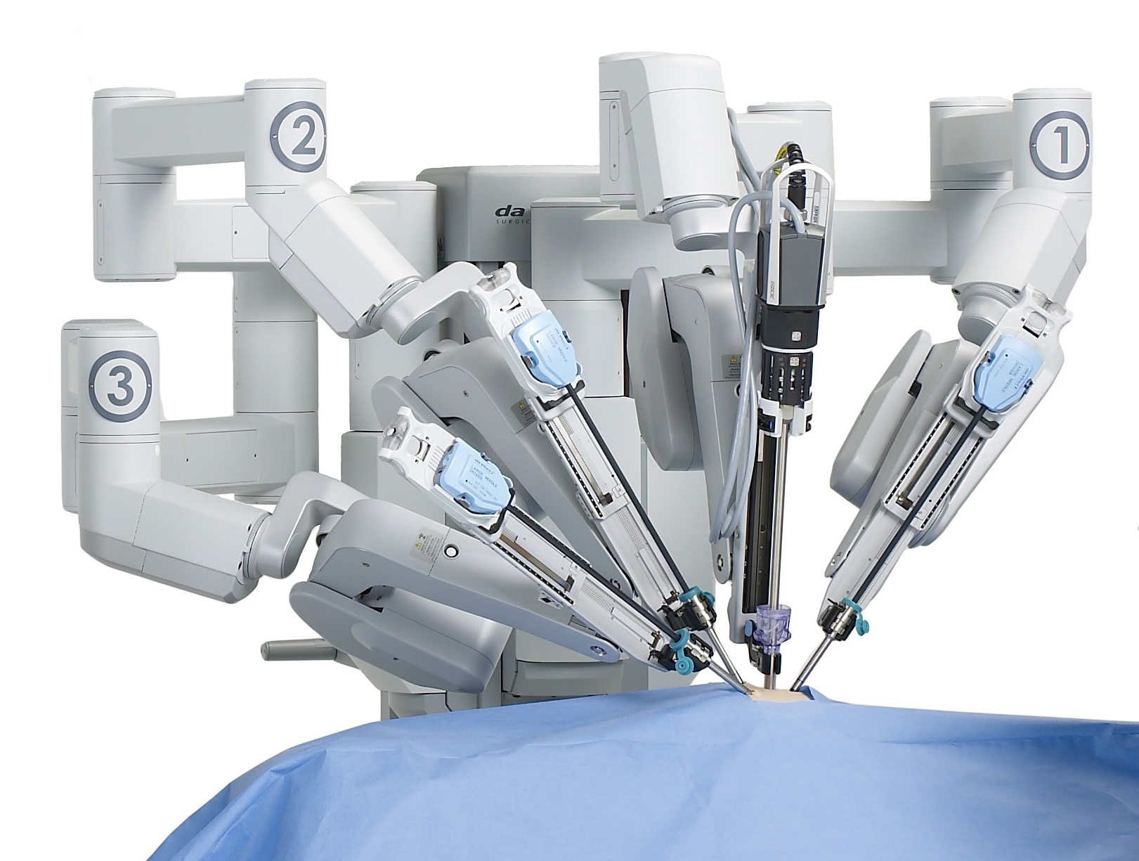 da Vinci surgical system robotic surgery in bangalore