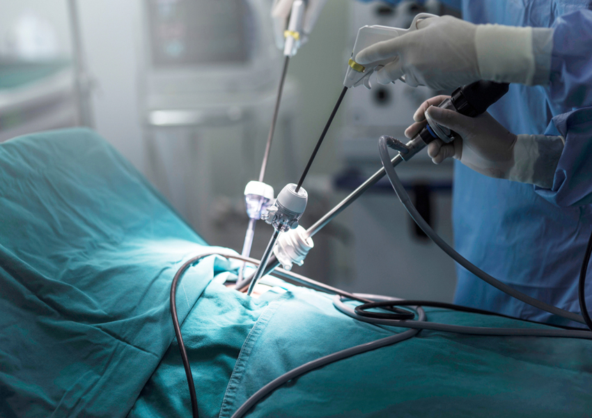 laparoscopic cancer surgery in Bangalore