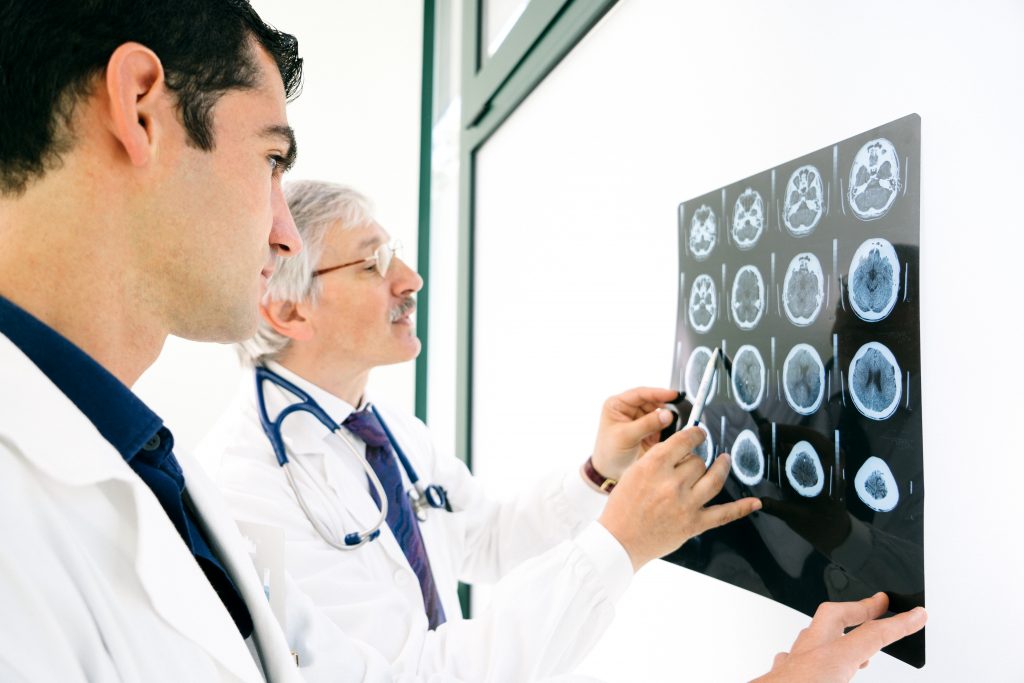 group of doctors looking stroke xray report for stroke treatment in bangalore